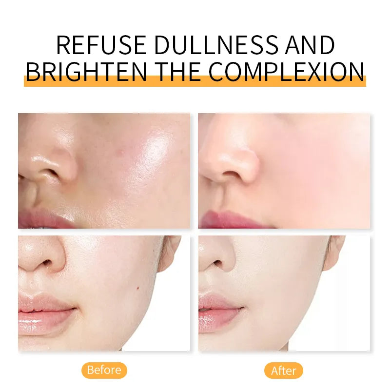 Dr.Rashel Acne Remover Stick with Tea Tree Oil A Beautiful Magic Stick - 7g