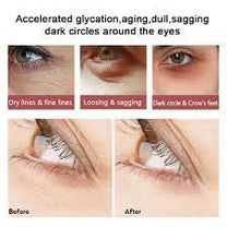 Collagen Under Eye Serum For Wrinkles, Sagging Puffiness, Dark Circles 20g Original ( Anti Aging )