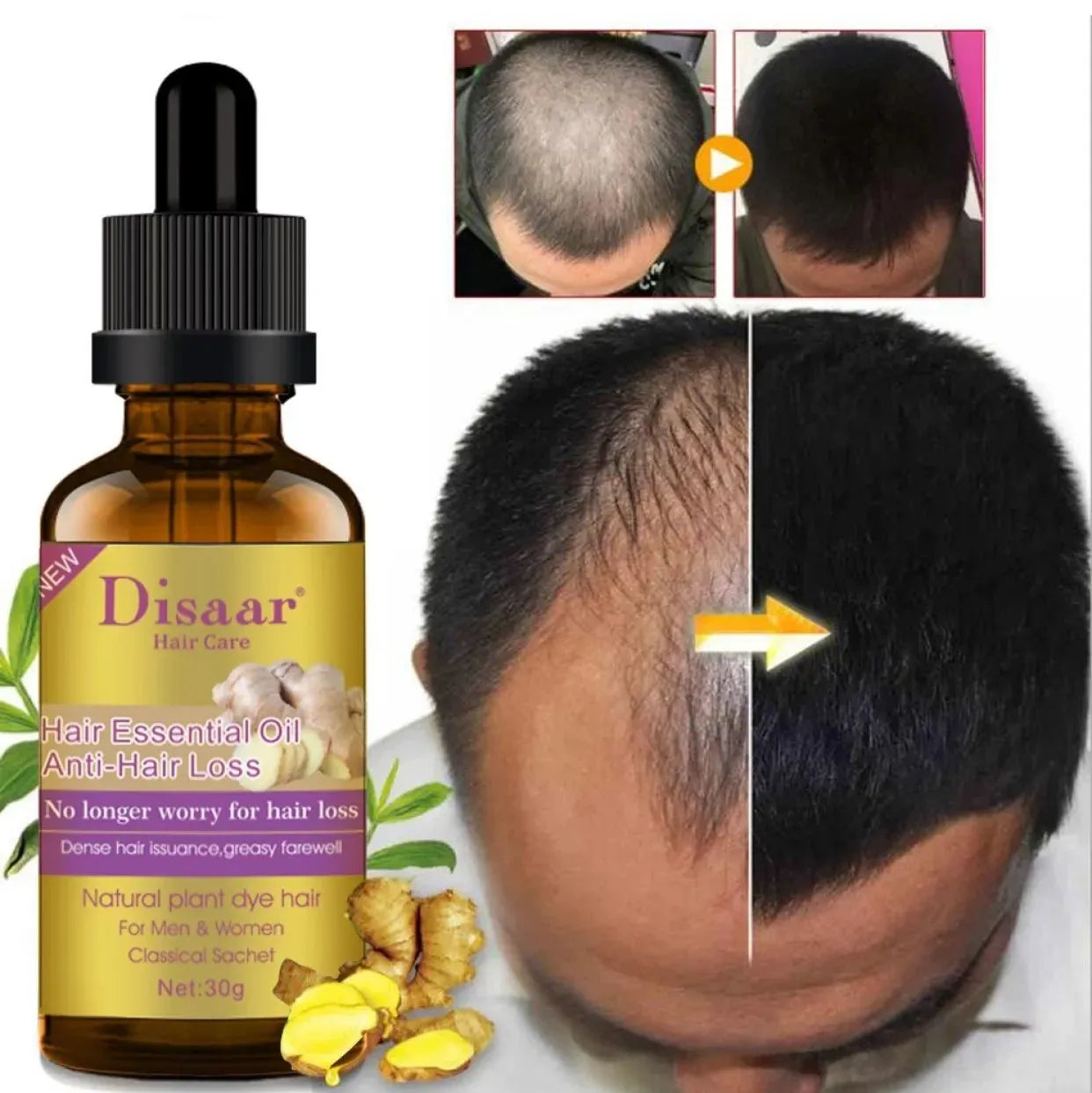 Disaar Anti-Hair Loss Ginger Oil – 30g