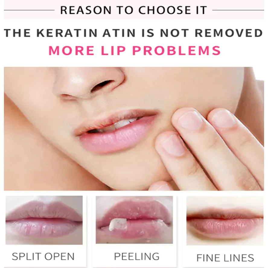 Estelin 3 In 1 Lip Care Set - Coffee 5g - Image 4