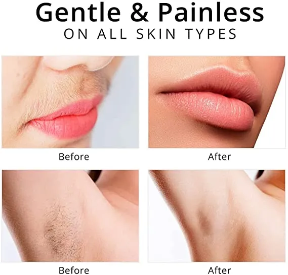 USB Rechargeable 2-in-1 Flawless Facial & Eyebrow Hair Remover Machine with LED Light