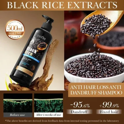Sadoer Black Rice Anti Hair Loss Anti Dandruff Shampoo - 500ml